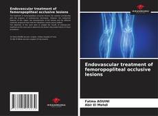 Bookcover of Endovascular treatment of femoropopliteal occlusive lesions
