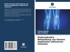 Capa do livro de Endovaskuläre Behandlung von femoro-poplitealen okklusiven Läsionen 