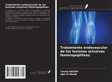 Buchcover von Tratamiento endovascular de las lesiones oclusivas femoropoplíteas