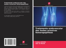 Buchcover von Tratamento endovascular das lesões oclusivas femoropoplíteas