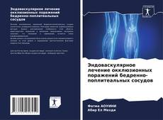 Buchcover von Эндоваскулярное лечение окклюзионных поражений бедренно-поплитеальных сосудов