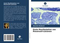 Buchcover von Orale Manifestation von Riesenzell-Läsionen