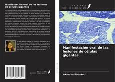 Buchcover von Manifestación oral de las lesiones de células gigantes