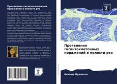 Capa do livro de Проявления гигантоклеточных поражений в полости рта 