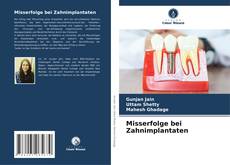 Buchcover von Misserfolge bei Zahnimplantaten