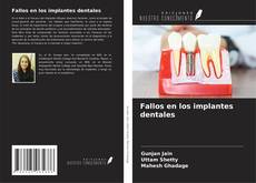 Обложка Fallos en los implantes dentales