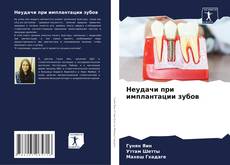Capa do livro de Неудачи при имплантации зубов 