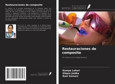 Buchcover von Restauraciones de composite