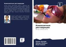 Bookcover of Композитные реставрации
