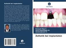 Bookcover of Ästhetik bei Implantaten