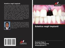 Bookcover of Estetica negli impianti