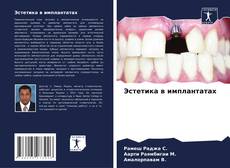 Bookcover of Эстетика в имплантатах