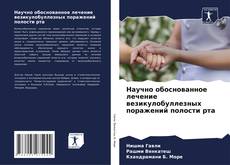 Capa do livro de Научно обоснованное лечение везикулобуллезных поражений полости рта 