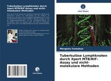 Buchcover von Tuberkulöse Lymphknoten durch Xpert MTB/RIF-Assay und nicht-molekulare Methoden