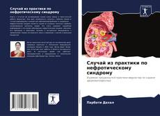Случай из практики по нефротическому синдрому的封面
