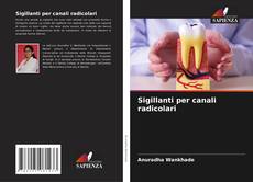 Bookcover of Sigillanti per canali radicolari