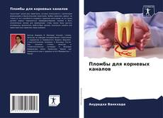 Buchcover von Пломбы для корневых каналов