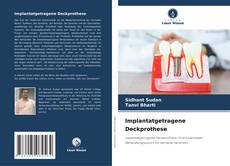Bookcover of Implantatgetragene Deckprothese
