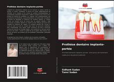 Bookcover of Prothèse dentaire implanto-portée