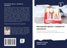 Capa do livro de Накладной протез с опорой на имплантат 