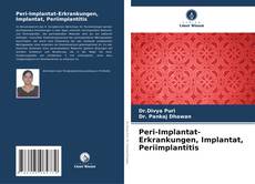 Buchcover von Peri-Implantat-Erkrankungen, Implantat, Periimplantitis