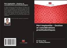 Buchcover von Péri-implantite - Gestion et considérations prosthodontiques