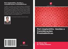 Peri-implantitis- Gestão e Considerações Prostodônticas的封面