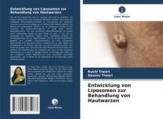 Bookcover of Entwicklung von Liposomen zur Behandlung von Hautwarzen