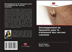 Buchcover von Développement de liposomes pour le traitement des verrues cutanées
