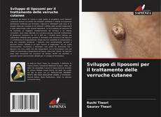 Bookcover of Sviluppo di liposomi per il trattamento delle verruche cutanee