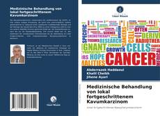 Bookcover of Medizinische Behandlung von lokal fortgeschrittenem Kavumkarzinom