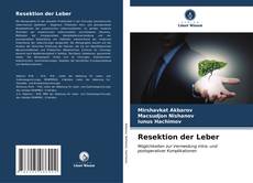 Portada del libro de Resektion der Leber