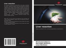 Bookcover of Liver resection