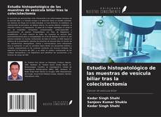 Bookcover of Estudio histopatológico de las muestras de vesícula biliar tras la colecistectomía