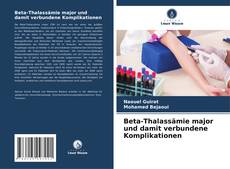 Bookcover of Beta-Thalassämie major und damit verbundene Komplikationen