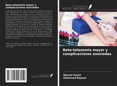 Buchcover von Beta-talasemia mayor y complicaciones asociadas