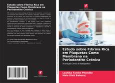 Estudo sobre Fibrina Rica em Plaquetas Como Membrana na Periodontite Crónica kitap kapağı