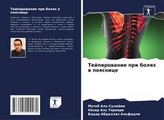 Copertina di Тейпирование при болях в пояснице