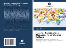 Malaria: Pathogenese, Diagnose, Kontrolle und Heilung的封面