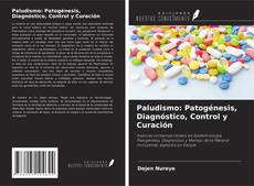 Buchcover von Paludismo: Patogénesis, Diagnóstico, Control y Curación