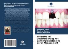 Buchcover von Probleme im Zusammenhang mit Zahnimplantaten und deren Management