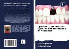 Buchcover von Проблемы, связанные с зубными имплантатами и их лечением