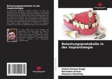Copertina di Belastungsprotokolle in der Implantologie