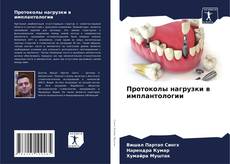 Buchcover von Протоколы нагрузки в имплантологии