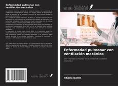 Enfermedad pulmonar con ventilación mecánica kitap kapağı