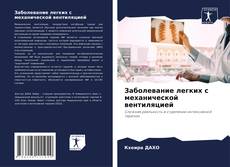 Borítókép a  Заболевание легких с механической вентиляцией - hoz