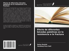 Capa do livro de Efecto de diferentes bóvedas palatinas en la resistencia a la fractura 