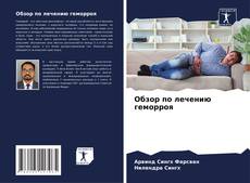 Buchcover von Обзор по лечению геморроя