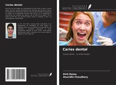 Caries dental kitap kapağı