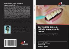 Bookcover of Carcinoma orale a cellule squamose in breve